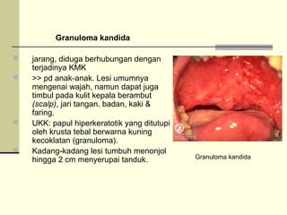 Granuloma kandida
 jarang, diduga berhubungan dengan
terjadinya KMK
 >> pd anak-anak. Lesi umumnya
mengenai wajah, namun dapat juga
timbul pada kulit kepala berambut
(scalp), jari tangan, badan, kaki &
faring.
 UKK: papul hiperkeratotik yang ditutupi
oleh krusta tebal berwarna kuning
kecoklatan (granuloma).
 Kadang-kadang lesi tumbuh menonjol
hingga 2 cm menyerupai tanduk. Granuloma kandida
 