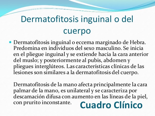 Que tal la psoriasis y como él manifiesta la foto
