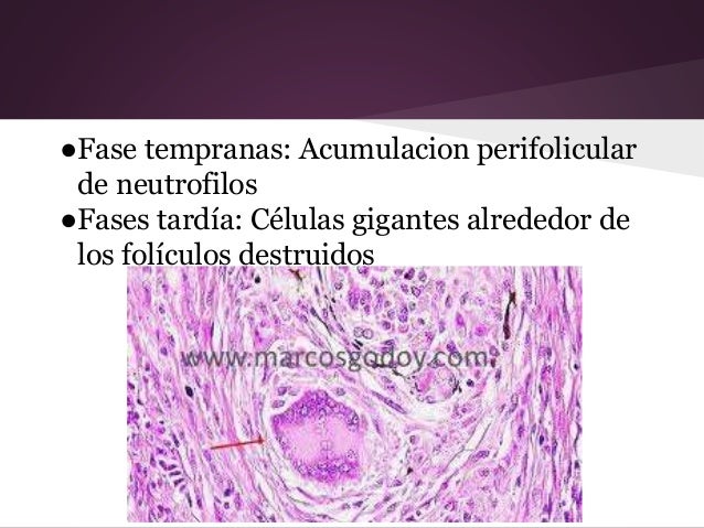 Como curar la uña que no se adhiere en las manos