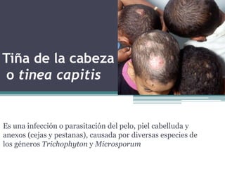 Tiña de la cabeza
o tinea capitis
Es una infección o parasitación del pelo, piel cabelluda y
anexos (cejas y pestanas), causada por diversas especies de
los géneros Trichophyton y Microsporum
 