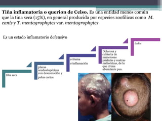 Tiña inflamatoria o querion de Celso. Es una entidad menos común
que la tina seca (15%), en general producida por especies zoofilicas como M.
canis y T. mentagrophytes var. mentagrophytes
Es un estado inflamatorio defensivo
tiña seca
placas
seudoalopécicas
con descamación y
pelos cortos
eritema
e inflamación
Dolorosa y
cubierta de
numerosas
pústulas y costras
melicéricas, de la
que drena
abundante pus.
dolor
 