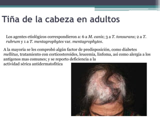 Tiña de la cabeza en adultos
Los agentes etiológicos correspondieron a: 6 a M. canis; 3 a T. tonsurans; 2 a T.
rubrum y 1 a T. mentagrophytes var. mentagrophytes.
A la mayoría se les comprobó algún factor de predisposición, como diabetes
mellitus, tratamiento con corticosteroides, leucemia, linfoma, así como alergia a los
antígenos mas comunes; y se reporto deficiencia a la
actividad sérica antidermatofitica
 