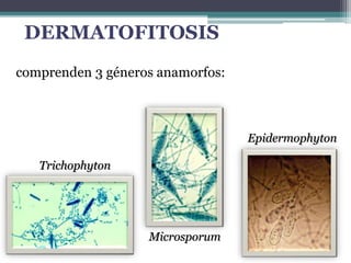 comprenden 3 géneros anamorfos:
Trichophyton
Microsporum
Epidermophyton
DERMATOFITOSIS
 