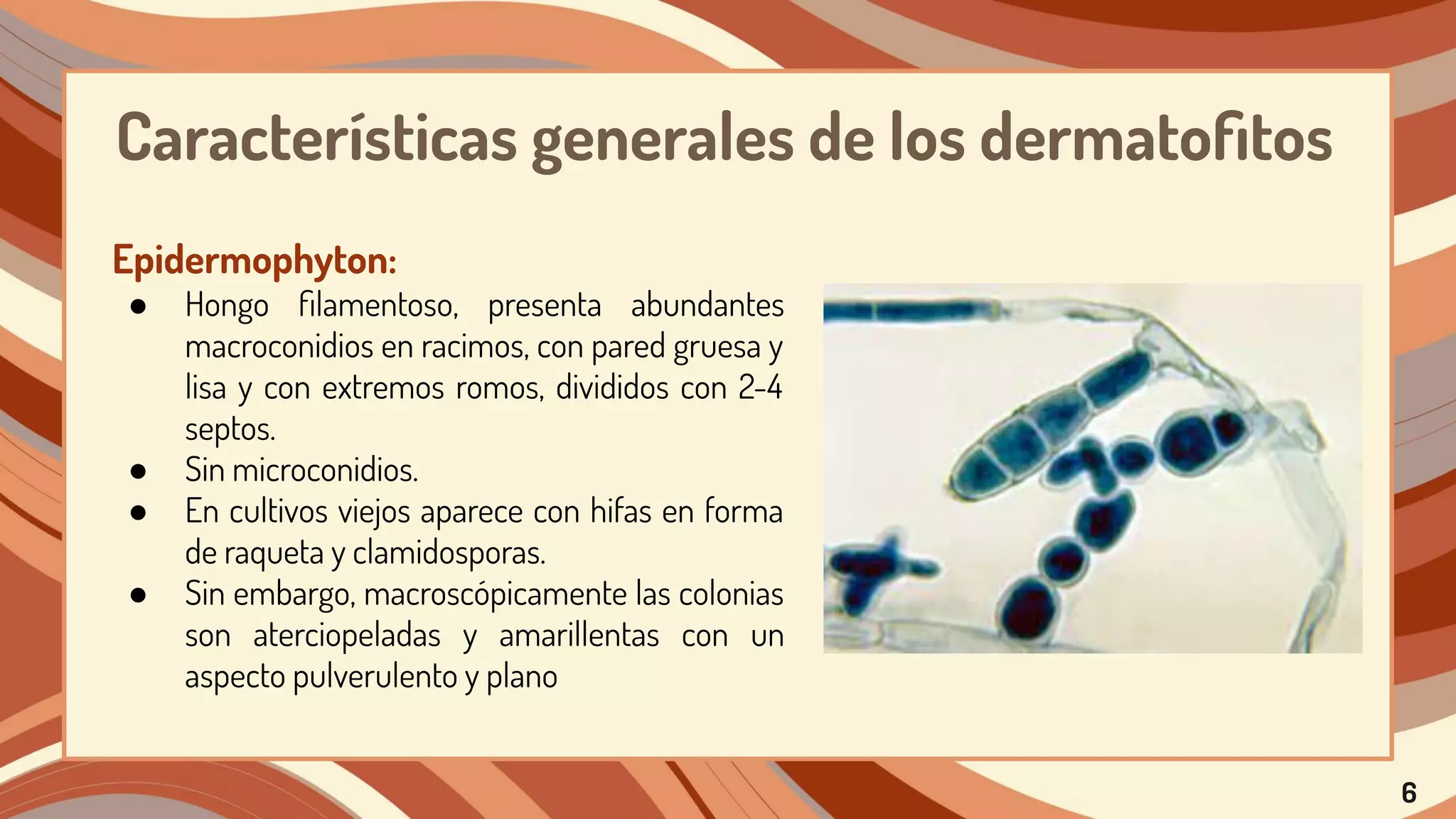 Dermatofitosis PDF