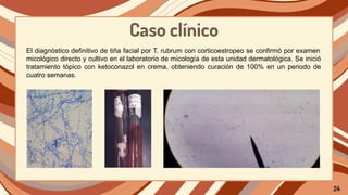Caso clínico
El diagnóstico definitivo de tiña facial por T. rubrum con corticoestropeo se confirmó por examen
micológico directo y cultivo en el laboratorio de micología de esta unidad dermatológica. Se inició
tratamiento tópico con ketoconazol en crema, obteniendo curación de 100% en un periodo de
cuatro semanas.
24
 