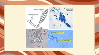 Dermatofitosis PDF