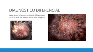 DIAGNÓSTICO DIFERENCIAL
La variedad inflamatoria deberá diferenciarse
con foliculitis decalvante y abscesos piógenos.
 