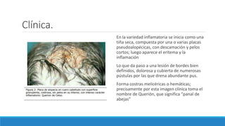 Clínica.
En la variedad inflamatoria se inicia como una
tiña seca, compuesta por una o varias placas
pseudoalopécicas, con descamación y pelos
cortos; luego aparece el eritema y la
inflamación
Lo que da paso a una lesión de bordes bien
definidos, dolorosa y cubierta de numerosas
pústulas por las que drena abundante pus.
Forma costras melicéricas o hemáticas;
precisamente por esta imagen clínica toma el
nombre de Querión, que significa “panal de
abejas”
 