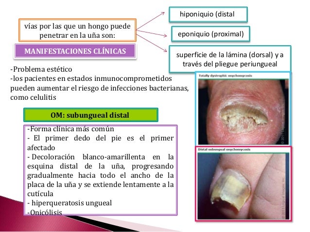 El hongo de la piel entre los dedos de los pies