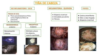 Endotrix Dermatofitos superficiales. expo alumnos.pdf