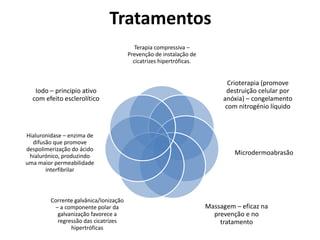 Tratamentos
Terapia compressiva –
Prevenção de instalação de
cicatrizes hipertróficas.
Crioterapia (promove
destruição celular por
anóxia) – congelamento
com nitrogénio líquido
Microdermoabrasão
Massagem – eficaz na
prevenção e no
tratamento
Corrente galvânica/Ionização
– a componente polar da
galvanização favorece a
regressão das cicatrizes
hipertróficas
Hialuronidase – enzima de
difusão que promove
despolimerização do ácido
hialurónico, produzindo
uma maior permeabilidade
interfibrilar
Iodo – principio ativo
com efeito esclerolítico
 