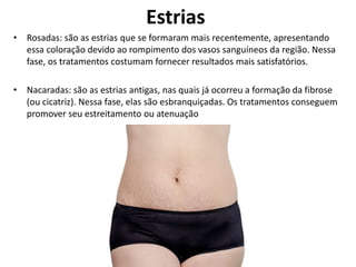Estrias
• Rosadas: são as estrias que se formaram mais recentemente, apresentando
essa coloração devido ao rompimento dos vasos sanguíneos da região. Nessa
fase, os tratamentos costumam fornecer resultados mais satisfatórios.
• Nacaradas: são as estrias antigas, nas quais já ocorreu a formação da fibrose
(ou cicatriz). Nessa fase, elas são esbranquiçadas. Os tratamentos conseguem
promover seu estreitamento ou atenuação
 