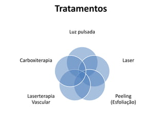 Tratamentos
Luz pulsada
Laser
Peeling
(Esfoliação)
Laserterapia
Vascular
Carboxiterapia
 