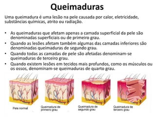 Queimaduras
Uma queimadura é uma lesão na pele causada por calor, eletricidade,
substâncias químicas, atrito ou radiação.
• As queimaduras que afetam apenas a camada superficial da pele são
denominadas superficiais ou de primeiro grau.
• Quando as lesões afetam também algumas das camadas inferiores são
denominadas queimaduras de segundo grau.
• Quando todas as camadas de pele são afetadas denominam-se
queimaduras de terceiro grau.
• Quando existem lesões em tecidos mais profundos, como os músculos ou
os ossos, denominam-se queimaduras de quarto grau.
 