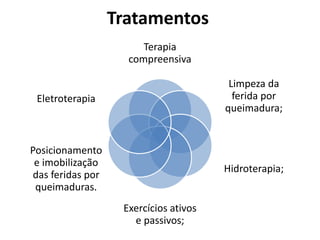 Tratamentos
Terapia
compreensiva
Limpeza da
ferida por
queimadura;
Hidroterapia;
Exercícios ativos
e passivos;
Posicionamento
e imobilização
das feridas por
queimaduras.
Eletroterapia
 