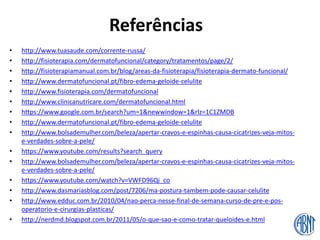 Referências
• http://www.tuasaude.com/corrente-russa/
• http://fisioterapia.com/dermatofuncional/category/tratamentos/page/2/
• http://fisioterapiamanual.com.br/blog/areas-da-fisioterapia/fisioterapia-dermato-funcional/
• http://www.dermatofuncional.pt/fibro-edema-geloide-celulite
• http://www.fisioterapia.com/dermatofuncional
• http://www.clinicanutricare.com/dermatofuncional.html
• https://www.google.com.br/search?um=1&newwindow=1&rlz=1C1ZMDB
• http://www.dermatofuncional.pt/fibro-edema-geloide-celulite
• http://www.bolsademulher.com/beleza/apertar-cravos-e-espinhas-causa-cicatrizes-veja-mitos-
e-verdades-sobre-a-pele/
• https://www.youtube.com/results?search_query
• http://www.bolsademulher.com/beleza/apertar-cravos-e-espinhas-causa-cicatrizes-veja-mitos-
e-verdades-sobre-a-pele/
• https://www.youtube.com/watch?v=VWFD96Qi_co
• http://www.dasmariasblog.com/post/7206/ma-postura-tambem-pode-causar-celulite
• http://www.edduc.com.br/2010/04/nao-perca-nesse-final-de-semana-curso-de-pre-e-pos-
operatorio-e-cirurgias-plasticas/
• http://nerdmd.blogspot.com.br/2011/05/o-que-sao-e-como-tratar-queloides-e.html
 