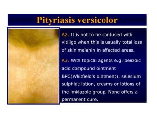Pityriasis versicolor
      A2. It is not to he confused with
      vitiligo when this is usually total loss
      of skin melanin in affected areas.

      A3. With topical agents e.g. benzoic
      acid compound ointment
      BPC(Whitfield's ointment), selenium
      sulphide lotion, creams or lotions of
      the imidazole group. None offers a
      permanent cure.
 