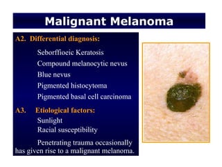 Malignant Melanoma
A2. Differential diagnosis:
       Seborffioeic Keratosis
       Compound melanocytic nevus
       Blue nevus
       Pigmented histocytoma
       Pigmented basal cell carcinoma
A3.   Etiological factors:
      Sunlight
      Racial susceptibility
       Penetrating trauma occasionally
has given rise to a malignant melanoma.
 