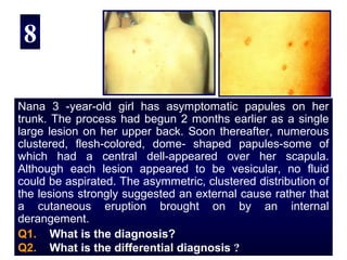 8

Nana 3 -year-old girl has asymptomatic papules on her
trunk. The process had begun 2 months earlier as a single
large lesion on her upper back. Soon thereafter, numerous
clustered, flesh-colored, dome- shaped papules-some of
which had a central dell-appeared over her scapula.
Although each lesion appeared to be vesicular, no fluid
could be aspirated. The asymmetric, clustered distribution of
the lesions strongly suggested an external cause rather that
a cutaneous eruption brought on by an internal
derangement.
Q1. What is the diagnosis?
Q2. What is the differential diagnosis ?
 