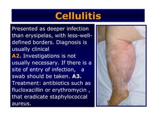 Cellulitis
Presented as deeper infection
than erysipelas, with less-well-
defined borders. Diagnosis is
usually clinical
A2. Investigations is not
usually necessary. If there is a
site of entry of infection, a
swab should be taken. A3.
Treatment: antibiotics such as
flucloxacillin or erythromycin ,
that eradicate staphylococcal
aureus.
 