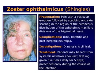 Zoster ophthalmicus (Shingles)
           Presentation: Pain with a vesicular
           eruption followed by scabbing and skin
           scarring in the region of the cutaneous
           distribution of the ophthalmic maxillary
           divisions of the trigeminal nerve.

           Complications: Iritis, keratitis and
           post-herpetic neuralgia.

           Investigations: Diagnosis is clinical.

           Treatment: Patients may benefit from
           systemic acyclovir (Zovirax; 800 mg
           given five times daily for 5 days)
           prescribed early during the course of
           the infection.
 
