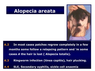 Alopecia areata




A.2   In most cases patches regrow completely in a few
  months some follow a relapsing pattern and 'm some
  cases A the hair is lost ( Alopecia totalis).

A.3   Ringworm infection (tinea capitis), hair plucking.

A.4   SLE, Secondary syphilis, sickle cell anaemia
 