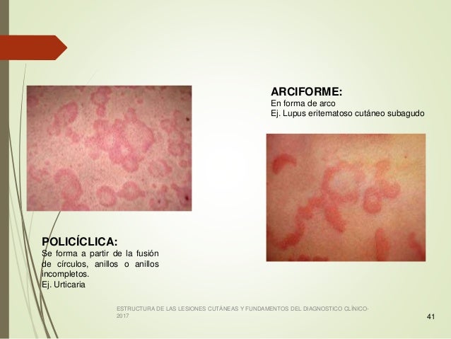 Lesiones Primarias y Secundarias de la Piel