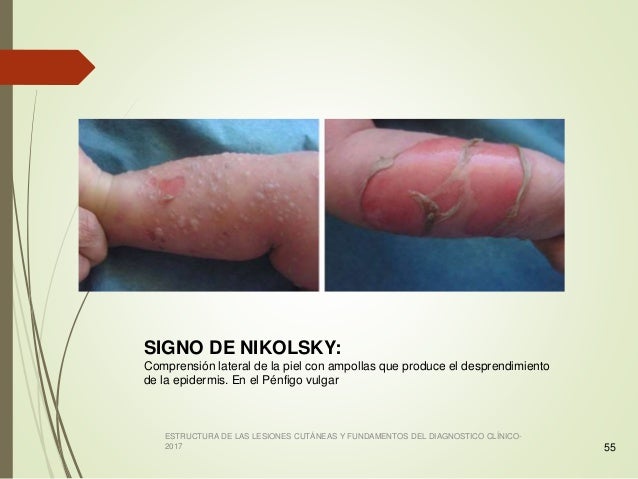 Lesiones Primarias y Secundarias de la Piel