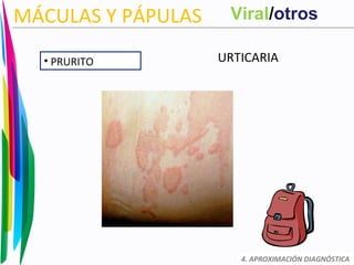 MÁCULAS Y PÁPULAS
URTICARIA
4. APROXIMACIÓN DIAGNÓSTICA
• PRURITO
Viral/otros
 