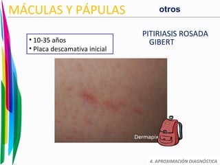 PITIRIASIS ROSADA
GIBERT
4. APROXIMACIÓN DIAGNÓSTICA
MÁCULAS Y PÁPULAS
• 10-35 años
• Placa descamativa inicial
otros
 