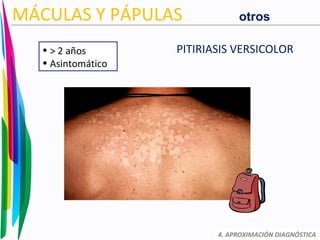 PITIRIASIS VERSICOLOR
4. APROXIMACIÓN DIAGNÓSTICA
MÁCULAS Y PÁPULAS
• > 2 años
• Asintomático
otros
 