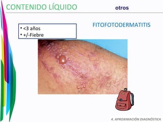 FITOFOTODERMATITIS
CONTENIDO LÍQUIDO
4. APROXIMACIÓN DIAGNÓSTICA
otros
• <3 años
• +/-Fiebre
 