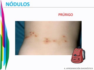 NÓDULOS
PRÚRIGO
4. APROXIMACIÓN DIAGNÓSTICA
 