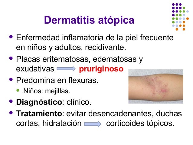 Se puede comer los huevos a la psoriasis