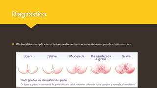 Diagnóstico
 Clínico, debe cumplir con: eritema, exulceraciones o excoriaciones, pápulas eritematosas.
 