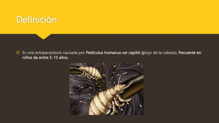 Definición
 Es una ectoparasitosis causada por Pediculus humanus var capitis (piojo de la cabeza), frecuente en
niños de entre 5-15 años.
 