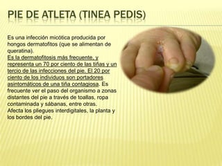 Pie de atleta (Tineapedis)Es una infección micótica producida por hongos dermatofitos (que se alimentan de queratina).Es la dermatofitosis más frecuente, y representa un 70 por ciento de las tiñas y un tercio de las infecciones del pie. El 20 por ciento de los individuos son portadores asintomáticos de una tiña contagiosa. Es frecuente ver el paso del organismo a zonas distantes del pie a través de toallas, ropa contaminada y sábanas, entre otras.Afecta los pliegues interdigitales, la planta y los bordes del pie.