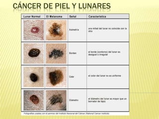 Cáncer de piel y lunares