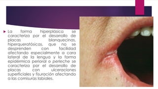  La forma hiperplásica se 
caracteriza por el desarrollo de 
placas blanquecinas, 
hiperqueratósicas, que no se 
desprenden con facilidad 
afectando especialmente a cara 
lateral de la lengua y la forma 
epidérmica perioral o perleche se 
caracteriza por el desarrollo de 
placas con ulceraciones 
superficiales y fisuración afectando 
a las comisuras labiales. 
 
