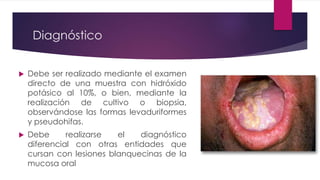 Diagnóstico 
 Debe ser realizado mediante el examen 
directo de una muestra con hidróxido 
potásico al 10%, o bien, mediante la 
realización de cultivo o biopsia, 
observándose las formas levaduriformes 
y pseudohifas. 
 Debe realizarse el diagnóstico 
diferencial con otras entidades que 
cursan con lesiones blanquecinas de la 
mucosa oral 
 