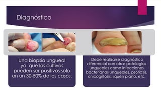 Diagnóstico 
Una biopsia ungueal 
ya que los cultivos 
pueden ser positivos solo 
en un 30-50% de los casos. 
Debe realizarse diagnóstico 
diferencial con otras patologías 
ungueales como infecciones 
bacterianas ungueales, psoriasis, 
onicogrifosis, liquen plano, etc. 
 