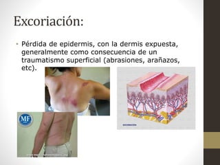 Dermatología (La Piel: Lesiones Elementales) | PPTX
