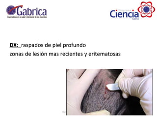 DX: raspados de piel profundo
zonas de lesión mas recientes y eritematosas
 