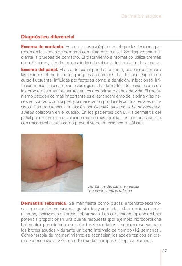 El tratamiento la psoriasis de la causa del surgimiento