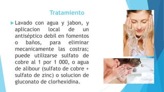 Tratamiento
 Lavado con agua y jabon, y
aplicacion local de un
antiséptico debil en fomentos
o baños, para eliminar
mecanicamente las costras;
puede utilizarse sulfato de
cobre al 1 por 1 000, o agua
de alibour (sulfato de cobre +
sulfato de zinc) o solucion de
gluconato de clorhexidina.
 