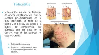 Foliculitis
 Inflamación aguda perifolicular
de origen estafilocócico, que se
localiza principalmente en la
piel cabelluda, la zona de la
barba y el bigote, las axilas o el
pubis; se caracteriza por
pústulas con un pelo en el
centro, que al desaparecer no
dejan cicatriz.
 