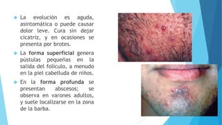  La evolución es aguda,
asintomática o puede causar
dolor leve. Cura sin dejar
cicatriz, y en ocasiones se
presenta por brotes.
 La forma superficial genera
pústulas pequeñas en la
salida del folículo, a menudo
en la piel cabelluda de niños.
 En la forma profunda se
presentan abscesos; se
observa en varones adultos,
y suele localizarse en la zona
de la barba.
 
