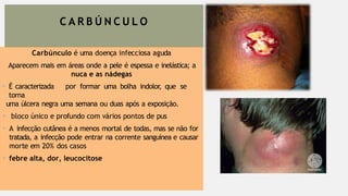 C A R B Ú N C U L O
Carbúnculo é uma doença infecciosa aguda
Aparecem mais em áreas onde a pele é espessa e inelástica; a
nuca e as nádegas
• É caracterizada por formar uma bolha indolor, que se
torna
uma úlcera negra uma semana ou duas após a exposição.
• bloco único e profundo com vários pontos de pus
• A infecção cutânea é a menos mortal de todas, mas se não for
tratada, a infecção pode entrar na corrente sanguínea e causar
morte em 20% dos casos
• febre alta, dor, leucocitose
 