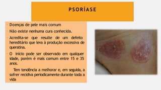 P S O R Í AS E
• Doenças de pele mais comum
• Não existe nenhuma cura conhecida.
• Acredita-se que resulte de um defeito
hereditário que leva à produção excessiva de
queratina.
• O início pode ser observado em qualquer
idade, porém é mais comum entre 15 e 35
anos.
• T
em tendência a melhorar e, em seguida, a
sofrer recidiva periodicamente durante toda a
vida
 