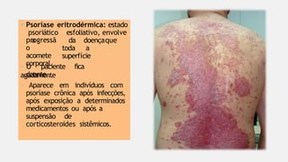 • Psoríase eritrodérmica: estado
psoriático esfoliativo, envolve
a da doençaque
toda a
superfície
progressã
o
acomete
corporal.
- O paciente fica
agudamente
doente.
- Aparece em indivíduos com
psoríase crônica após infecções,
após exposição a determinados
medicamentos ou após a
suspensão de
corticosteroides sistêmicos.
 